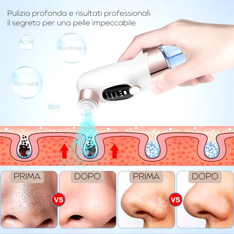 ClearSuction - Aspiratore Punti Neri Professionale