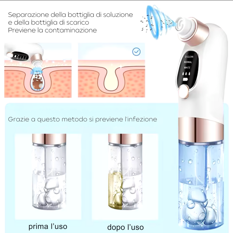 ClearSuction - Aspiratore Punti Neri Professionale